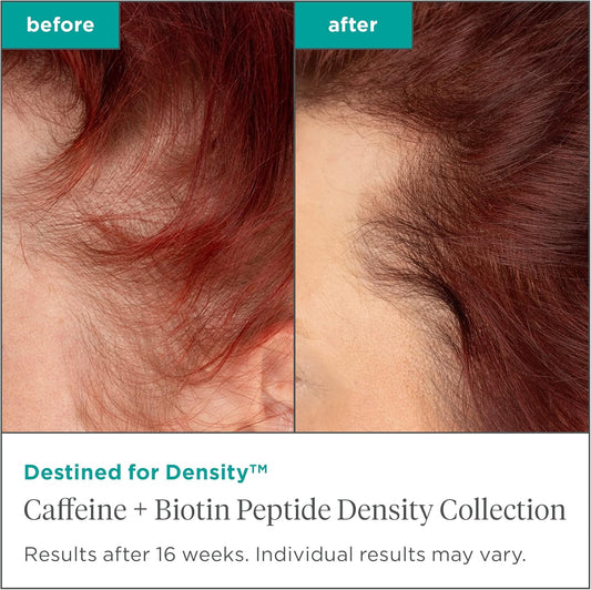 Briogeo Destined For Density Caffeine + Biotin Peptide Density Conditioner, Increases Hair Thickness And Density, Vegan, Phalate & Paraben-Free - 236Ml