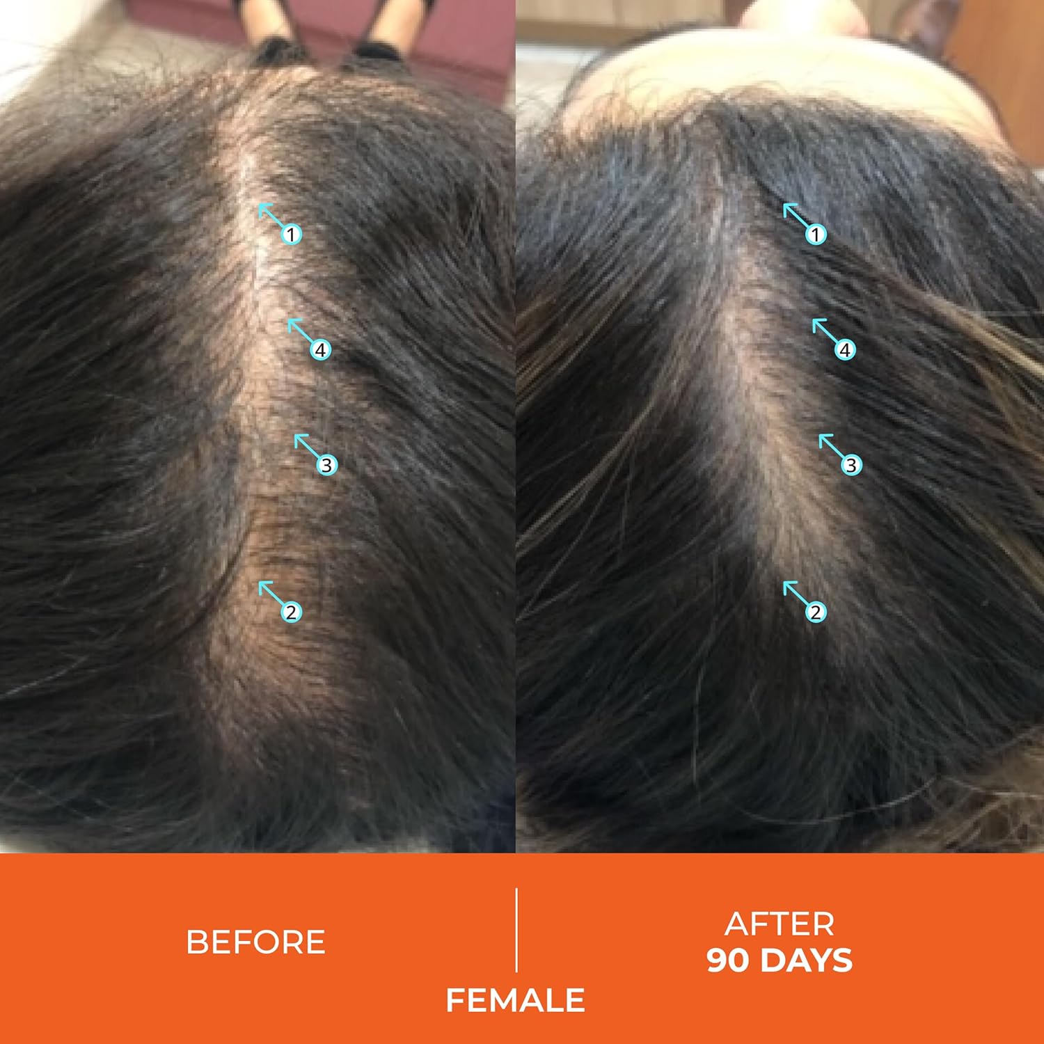 Ds Labs Revita Hair Vitamin Gummies - Support For Thicker, Fuller-Looking Hair, With Biotin, Zinc, Vitamin D, Iron, Magnesium & Melatonin, Vegan, Gluten-Free, Gelatin-Free, 60 Gummies : Health & Household