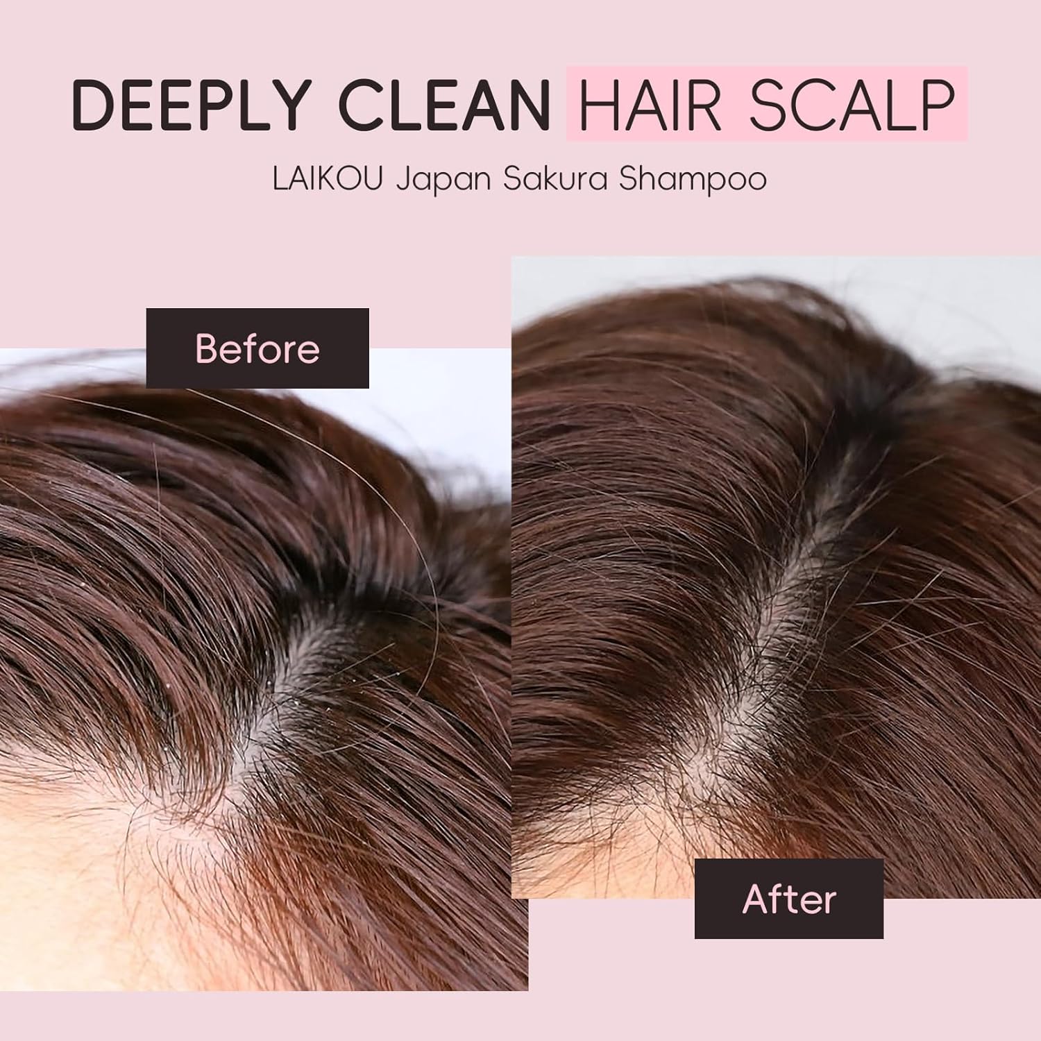 Japanese Sakura Shampoo, 14.10Oz Clarifying,Hydrating And Thickening Hair Care - Repairs, Shine, Strengthens Volumizing Vegan Shampoo For Dry Damaged Hair Care & Scalp Exfoliation, Pink