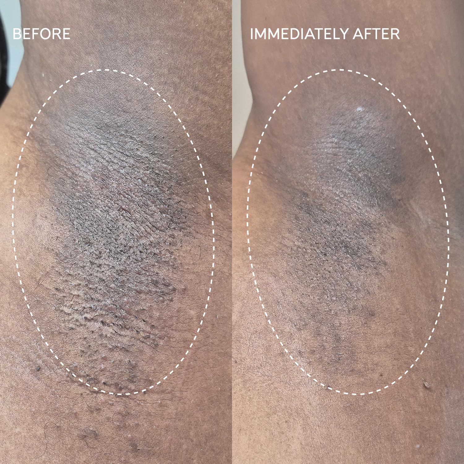 Fur Flash Repair Jelly – Hypochlorous Acid Aftercare Gel For Post-Wax, Shave, Or Laser – Soothes Redness, Bumps, And Irritation Dermatologist-Tested, Fragrance-Free (2.0 Fl Oz / 60Ml) : Beauty & Personal Care