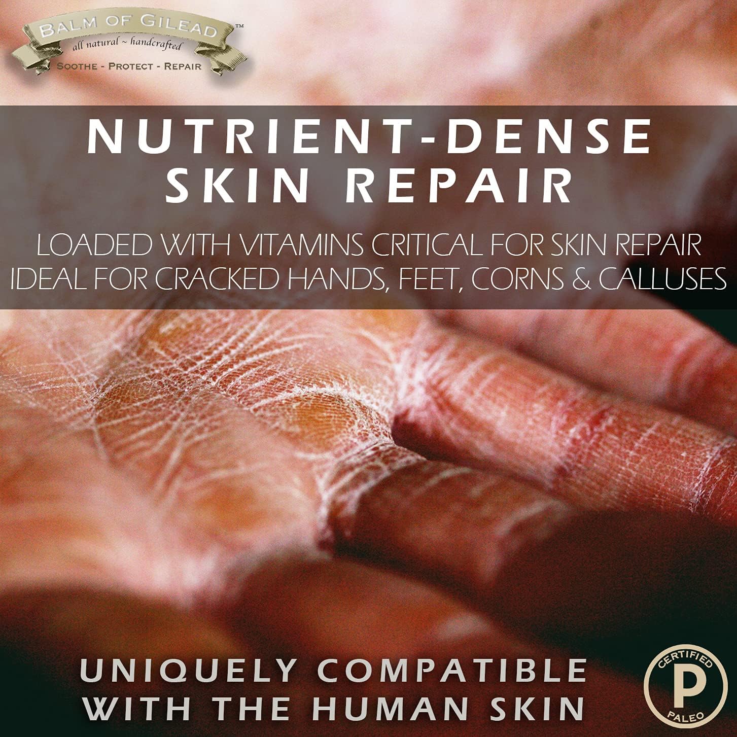 Manuka Defense Healing Balm With New Zealand Manuka & Australian Tea Tree Oil, Intensive Moisture Soothes + Softens Skin Irritations Such As Eczema, Skin Rashes, Dry Skin - 2 Oz