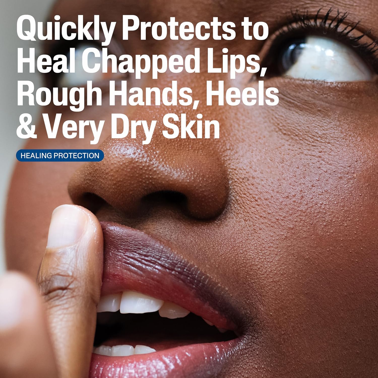 Cetaphil Healing Ointment, 3 Oz, For Dry, Chapped, Irritated Skin, Heals And Protects, Soothes Cracked Hands And Chapped Lips, Hypoallergenic, Fragrance Free : Beauty & Personal Care