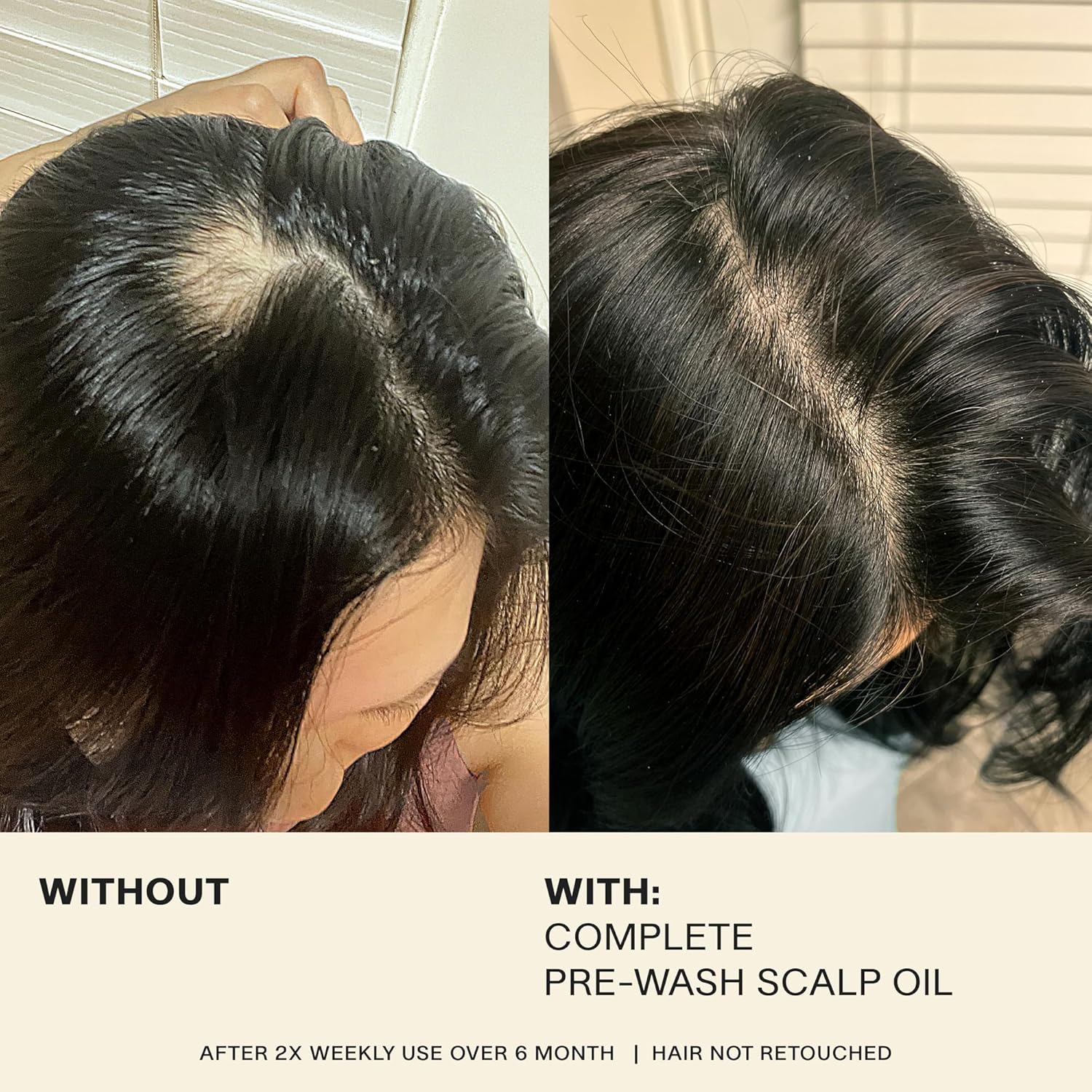 Jvn Complete Hair And Scalp Oil With Rosemary, Dry Scalp And Dry Hair Oil For All Hair Types, Silicone-Free, 1.7 Fluid Ounces : Beauty & Personal Care