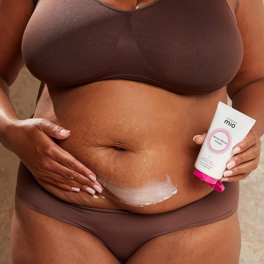 Mama Mio Mama Marks Cream 125Ml | Suitable For Pregnant Women, Vegan, Cruelty-Free, Dermatologically Tested