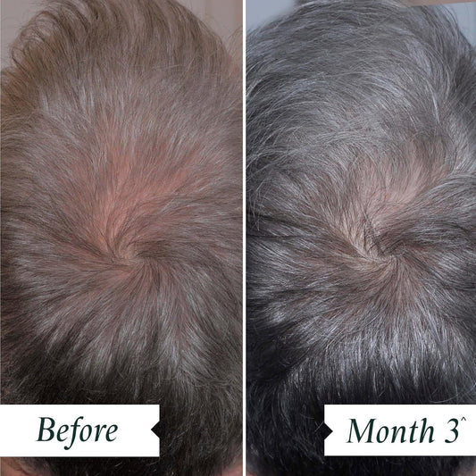 Philip Kingsley Density Preserving Scalp Drops