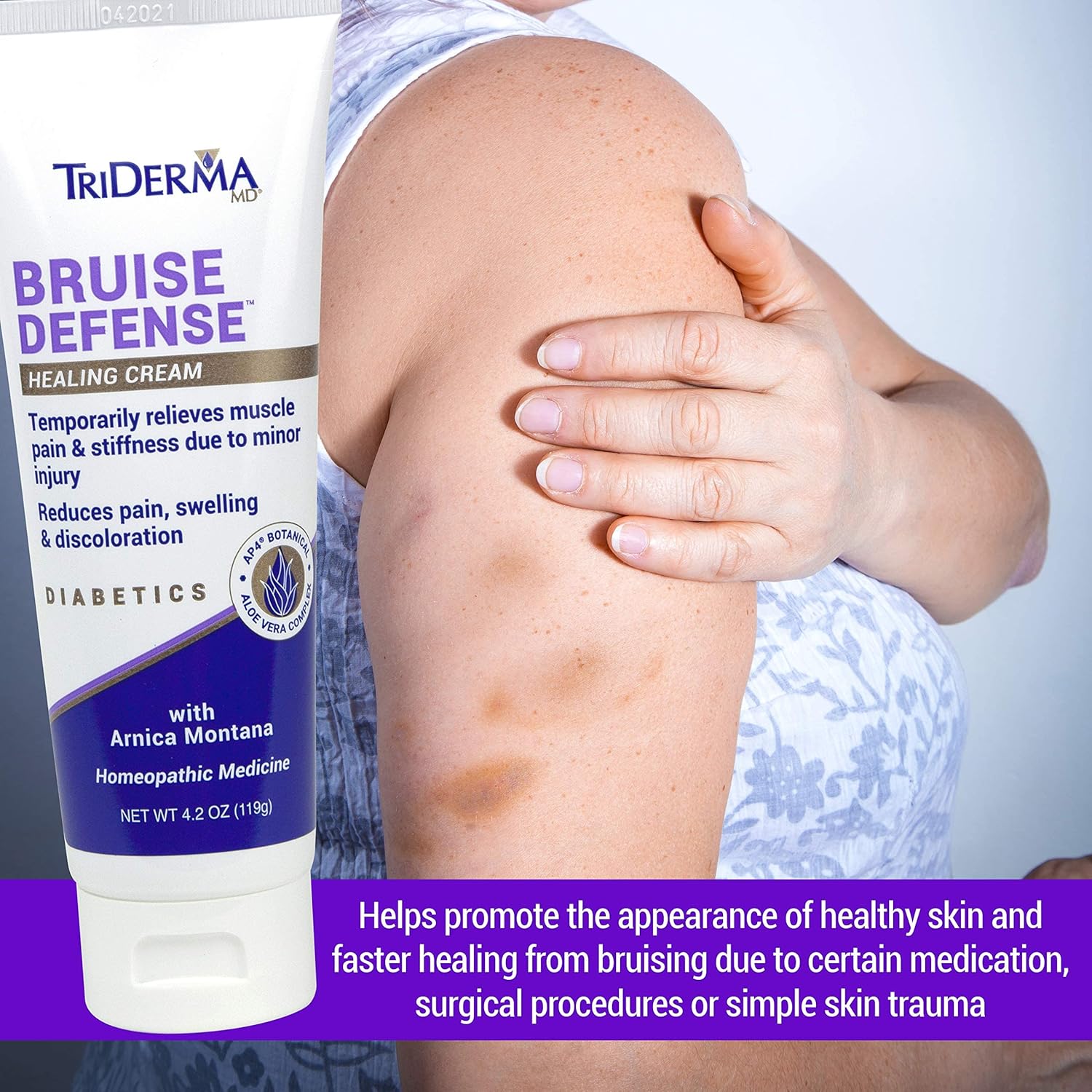 Triderma Bruise Defense Healing Cream For Skin Discoloration, Redness, Swelling, Thin Skin That Bruises Easily With Arnica, Msm And Ap4 Aloe 4.2 Ounces : Beauty & Personal Care