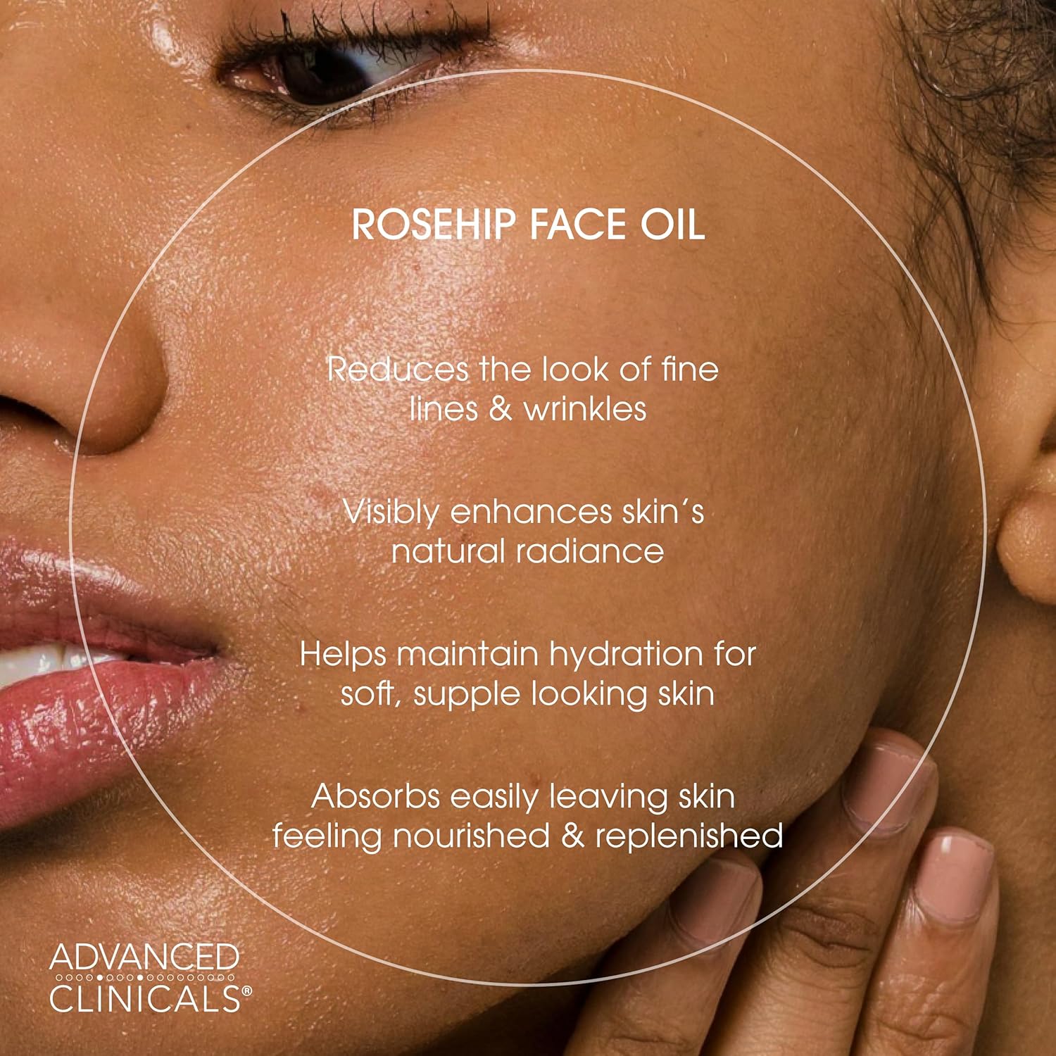 Advanced Clinicals Rosehip Oil For Face With Vitamin E + Botanicals Helps Improve Look Of Dark Spots, Wrinkles, Fine Lines, & Uneven Looking Skin Tone | Moisturizing Skin Care Face Serum, 1.8 Fl Oz : Beauty & Personal Care