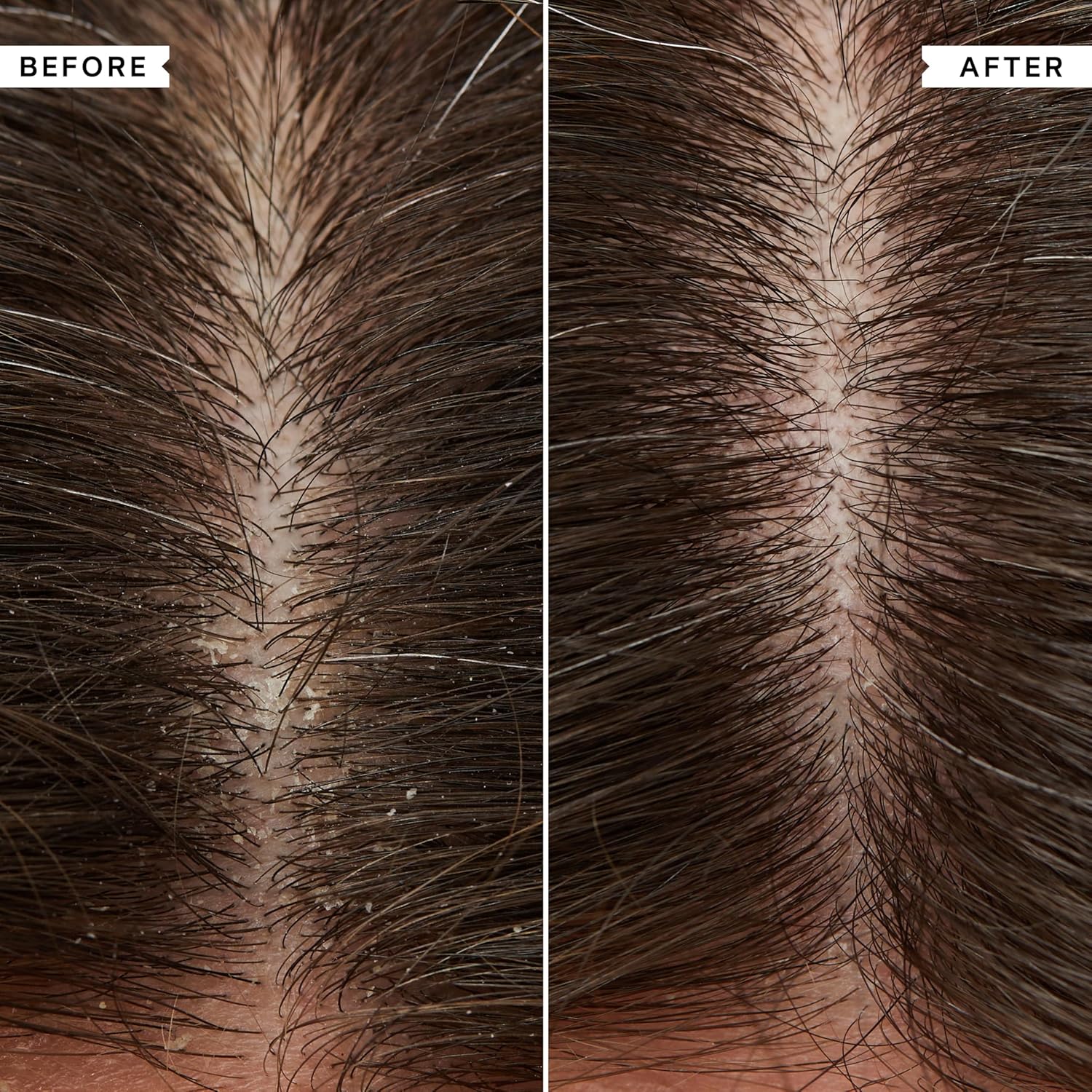 Philip Kingsley | Flaky/Itchy Scalp Conditioner | Anit-Dandruff Conditioner For Flaky, Itchy, Dry and/or Oily Scalps | Cleansing Scalp Care | Hydrates, Soothes, Calms and Detangles | 75ml : Amazon.co.uk: Beauty