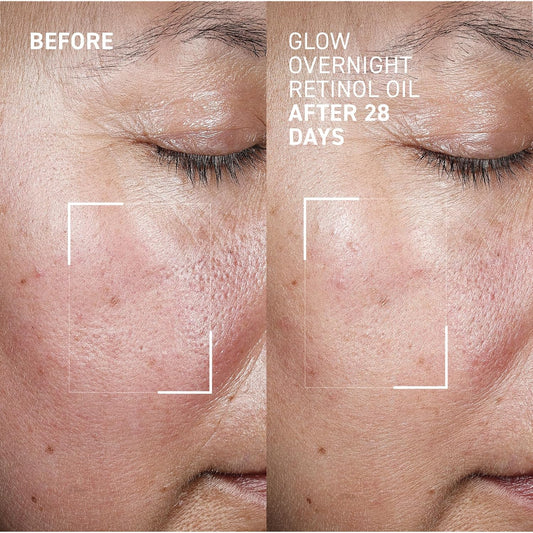 Dr. Brandt Bright This Way Glow Overnight Retinol Oil - Pure 2% Retinol Improves Wrinkles, Lines & Skin Texture - 1 Fl Oz
