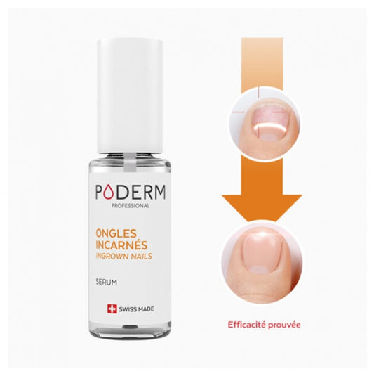 Poderm Ingrown Nail Serum 8Ml