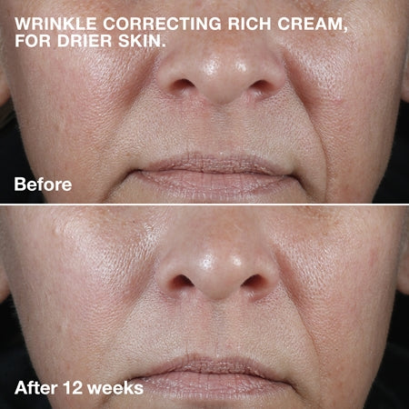 Clinique Smart Clinical™ Repair Wrinkle Correcting Cream Nourishing Anti-Wrinkle Cream 
