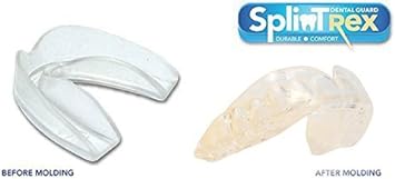 SplinTrex Multi Use Teeth Mouth Guards - 4 Pack - BPA Free - Teeth Grinding Dental Night Guard, Athletic Mouth Guard, Teeth Whitening Tray - Includes 4 Customizable Mouth Guards and Storage Case