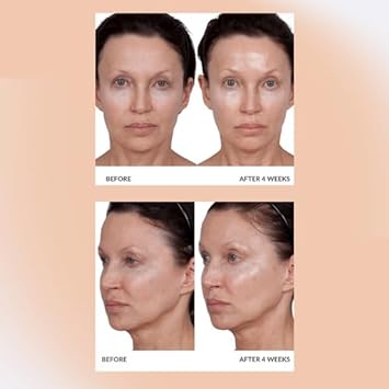 Consult Beaute Volumagen TRIO - Serum Concentrate, Volumizing Facial Cream & Eye Cream - Anti-Aging - Face, Neck & Eye - Collagen - Hyaluronic Acid