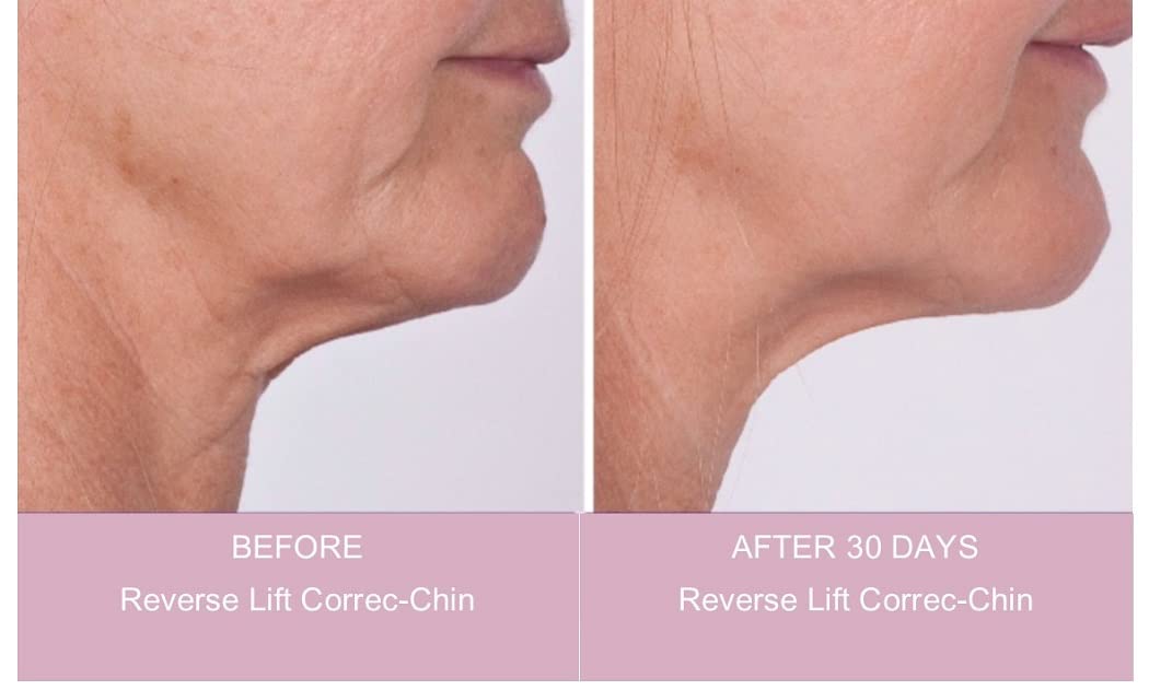 Serious Skincare Reverse Lift Correc-Chin Firming Cream for 