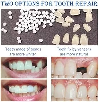 Tempoary Tooth Repair Kits DIY Dental Care Kit Glue for Fill