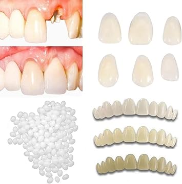 Womcare Temporary Tooth Repair Kits for Filling The Missing Broken Tooth and Gaps-Moldable Fake Teeth and Thermal Beads Replacement Kits