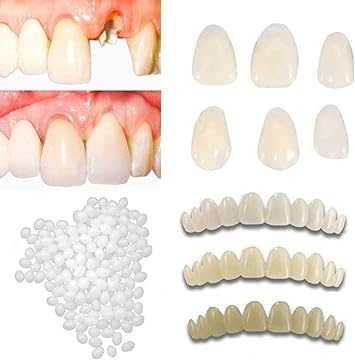 Tempoary Tooth Repair Kits DIY Dental Care Kit Glue for Filling Missing Broken Teeth Crowns and Bridges Moldable Fake Teeth to Regain Your Beautiful Smile in Minutes-White Color