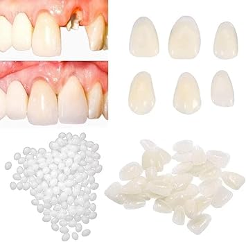 Temporary Tooth Repair Kits for Filling The Missing Broken Tooth and Gaps-Moldable Fake Teeth and Thermal Beads Replacement Kits