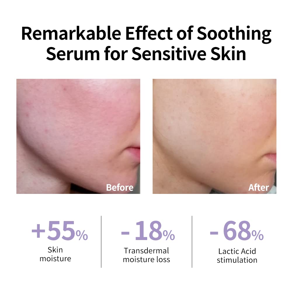 Esupli.com LANBENA Renewing Sooting Serum For Sensitive Skin Care, Soot