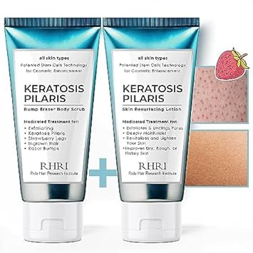 KP Bump Eraser Body Scrub + Keratosis Pilaris Lotion Bundle Set, Keratosis Pilaris Treatment, Strawberry Legs Treatment for Women, Bump Eraser Body Scrub, Keratosis Pilaris, Body Scrub for Strawberry Legs