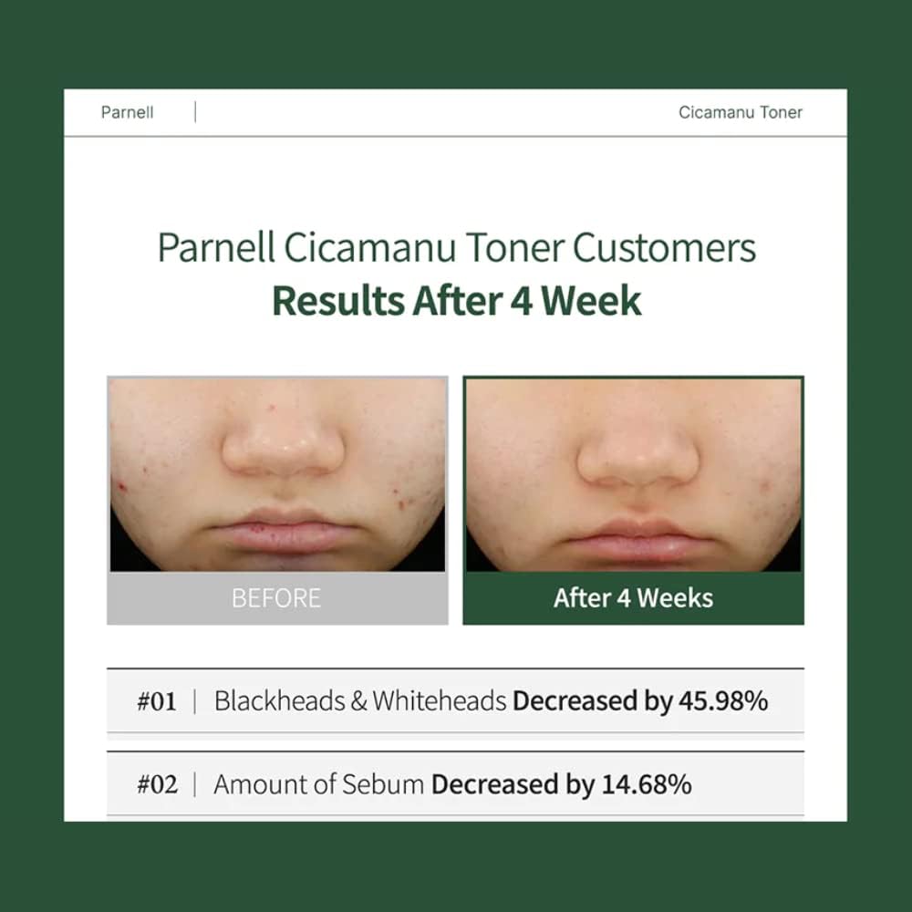 Parnell Cicamanu Toner for Sensitive, Dry Skin with Centella