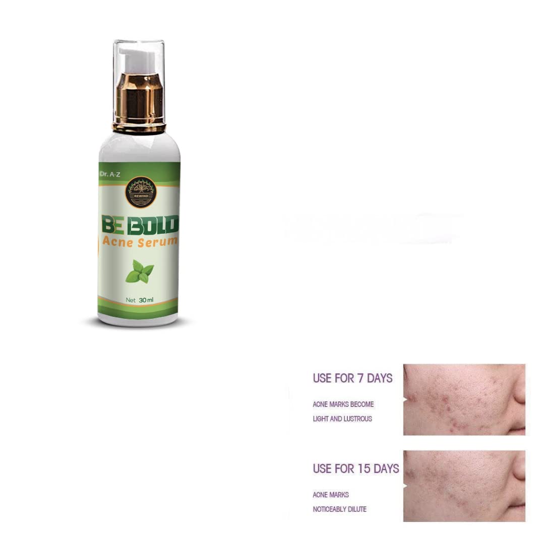 Esupli.com Be Bold Acne Treatment Serum, Cream Herbal Supports Relief o