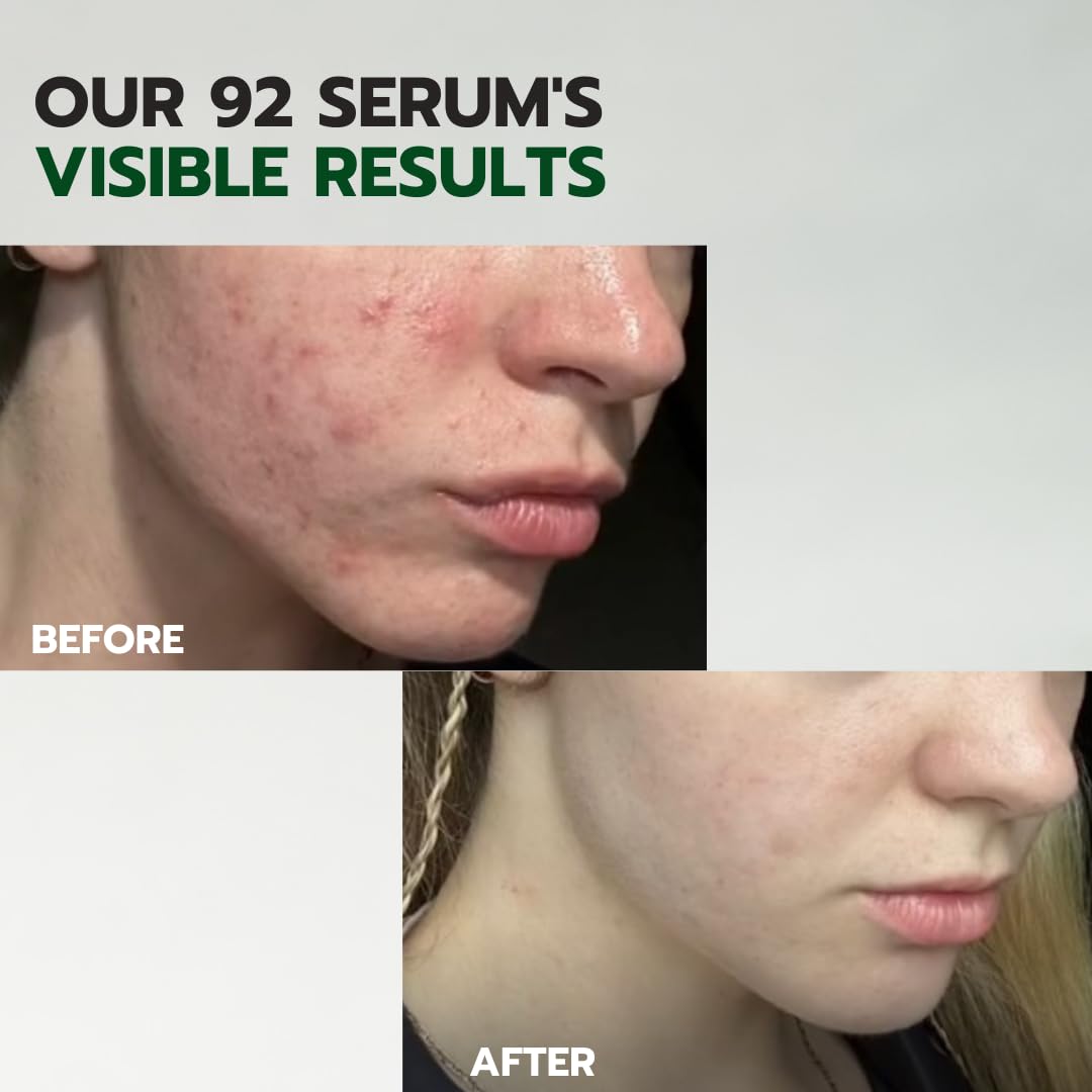 Esupli.com PARNELL Cicamanu 92 Serum for Textured Skin, Melatonin Serum