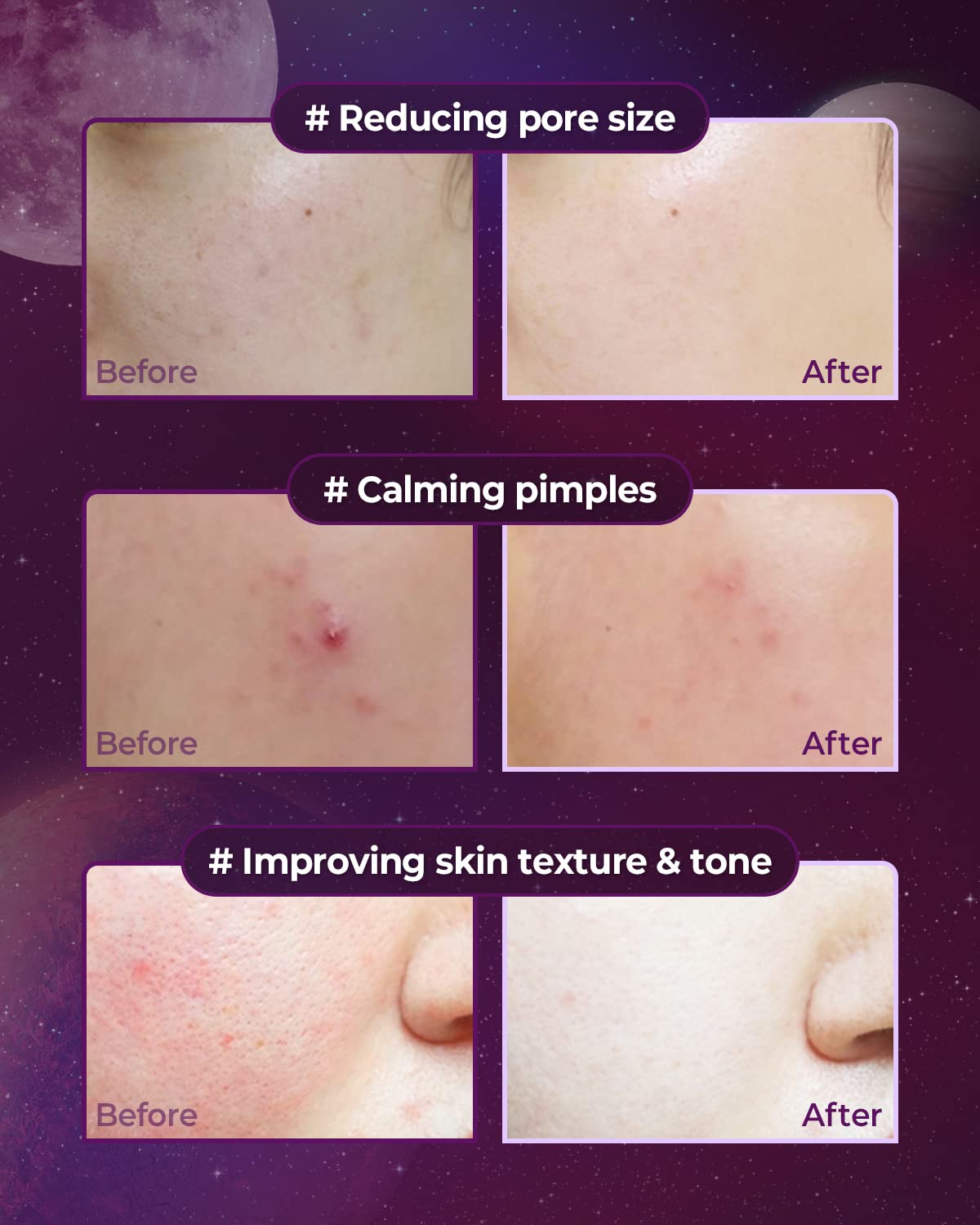 Esupli.com CRAZY SKIN Skin Repair Trouble Care Sleeping Cream 1.76oz | 
