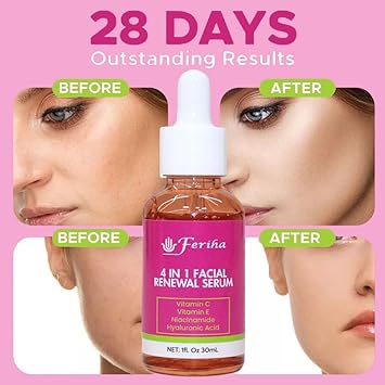 Esupli.com 4 in 1 Facial Renewal Serum, with Vitamin C and E, Hyaluroni