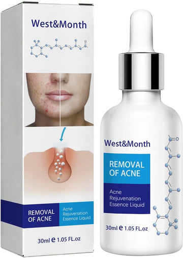 Sunlucky Acne Repair Essences Antis Wrinkle Essences Exfoliating Closed Blackheads Acne Pore Shrinkage Gentle Moisturizing 30 Oil for Face Before Makeup (White, One Size)