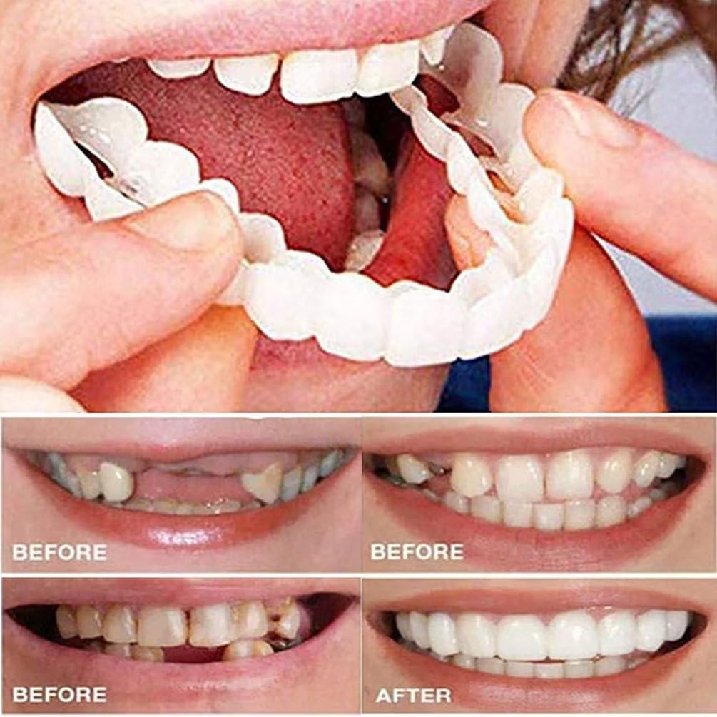 Womcare Temporary Tooth Repair Kits for Filling The Missing 