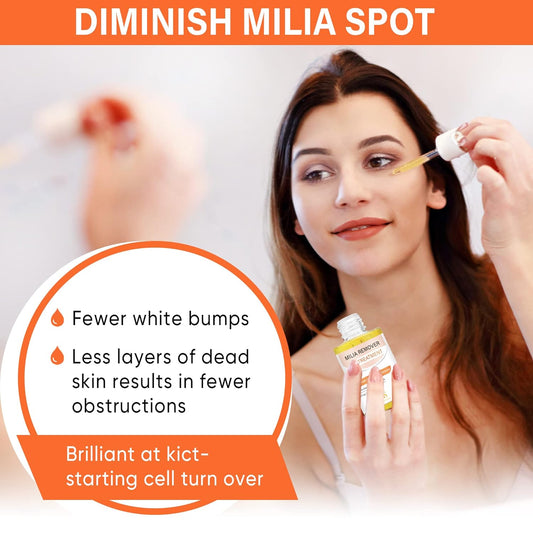 NOVENSA Milia Remover, Milia Spot Treatment Helps Dissolve and Reduce Milia, Whitehead, and Sebaceous Hyperplasia