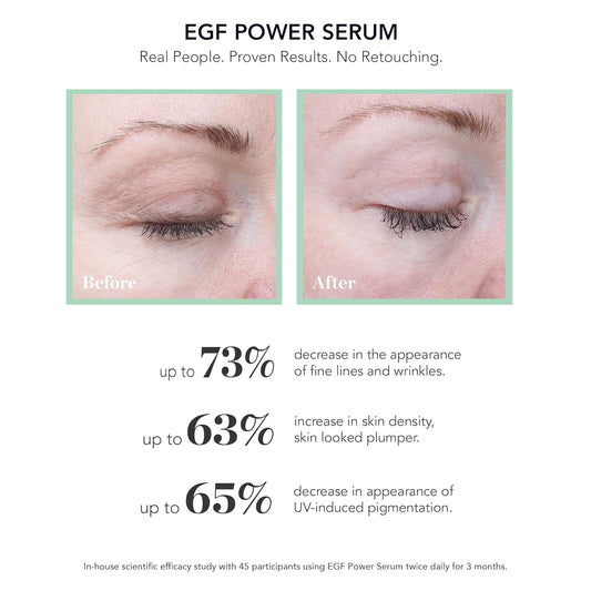 BIOEFFECT EGF Power Serum with Epidermal Growth Factor from Barley, Hyaluronic Acid, F and a form of Glucosamine (NAG) to Visibly Reduce Wrinkles & Discolorations, Hydrating Anti-Aging Treatment