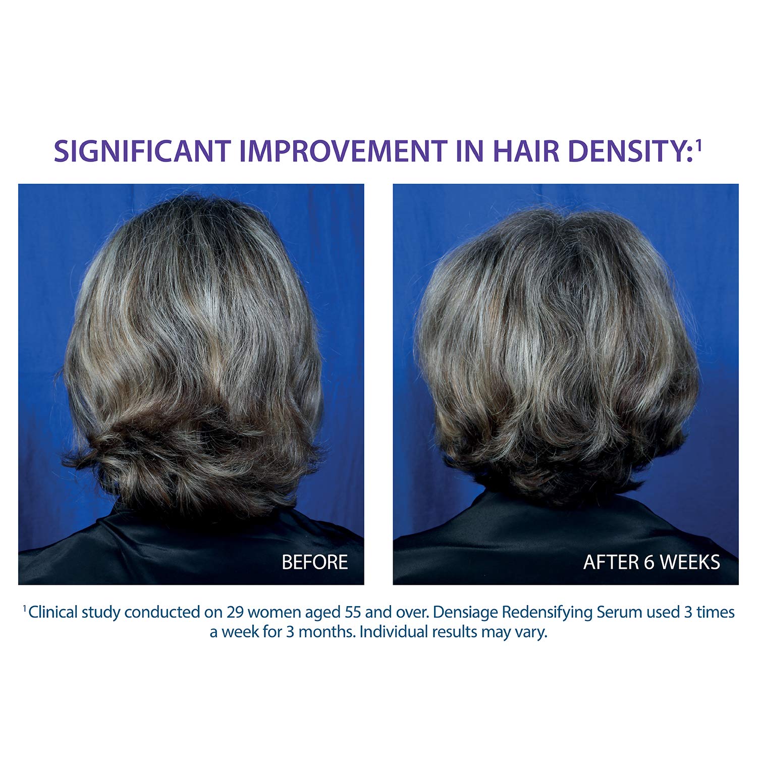 Esupli.com Ducray Densiage Redensifying Serum, Increases Hair Thickness