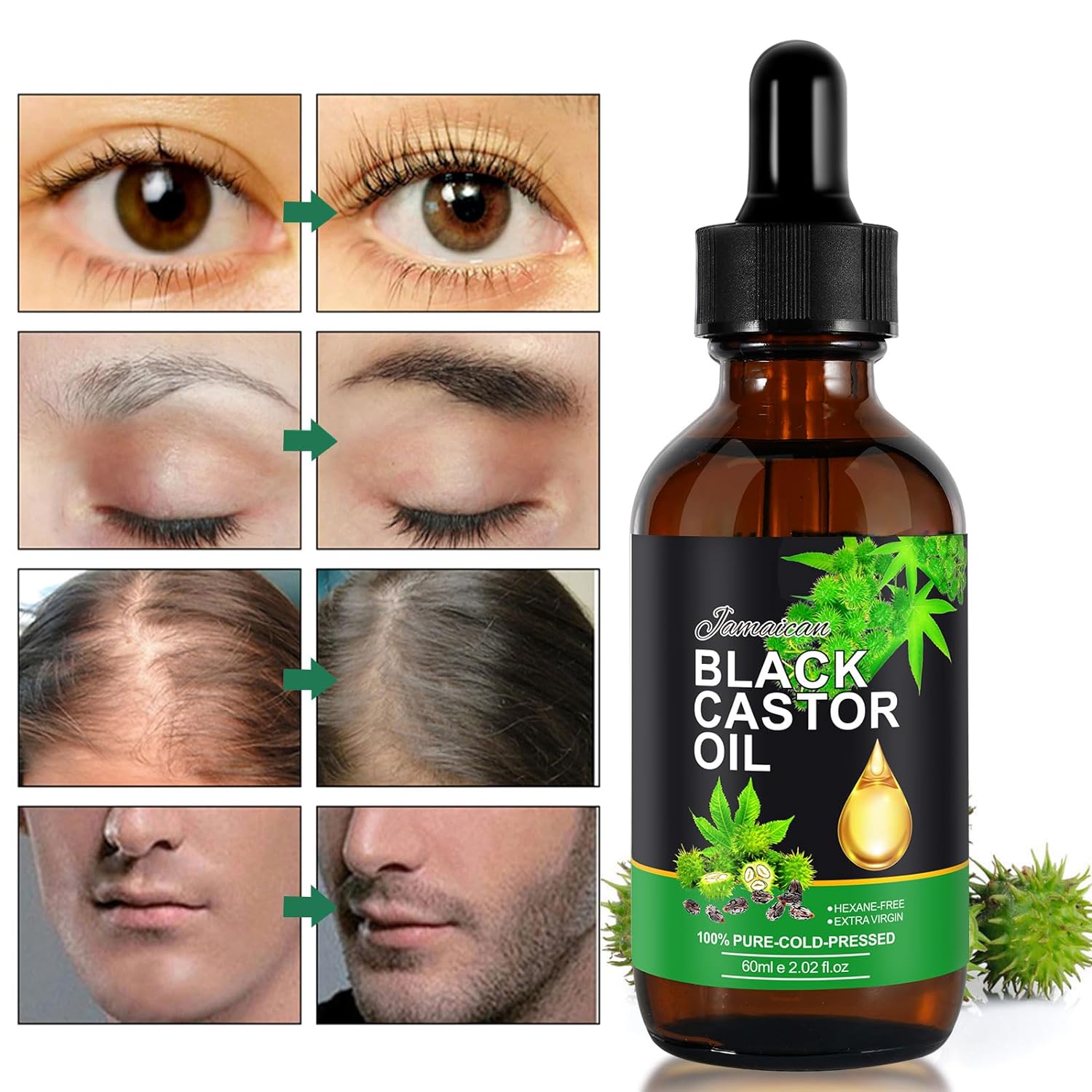 ALIVER Castor Oil, Jamaican Black Castor Oil,100% Pure Casto