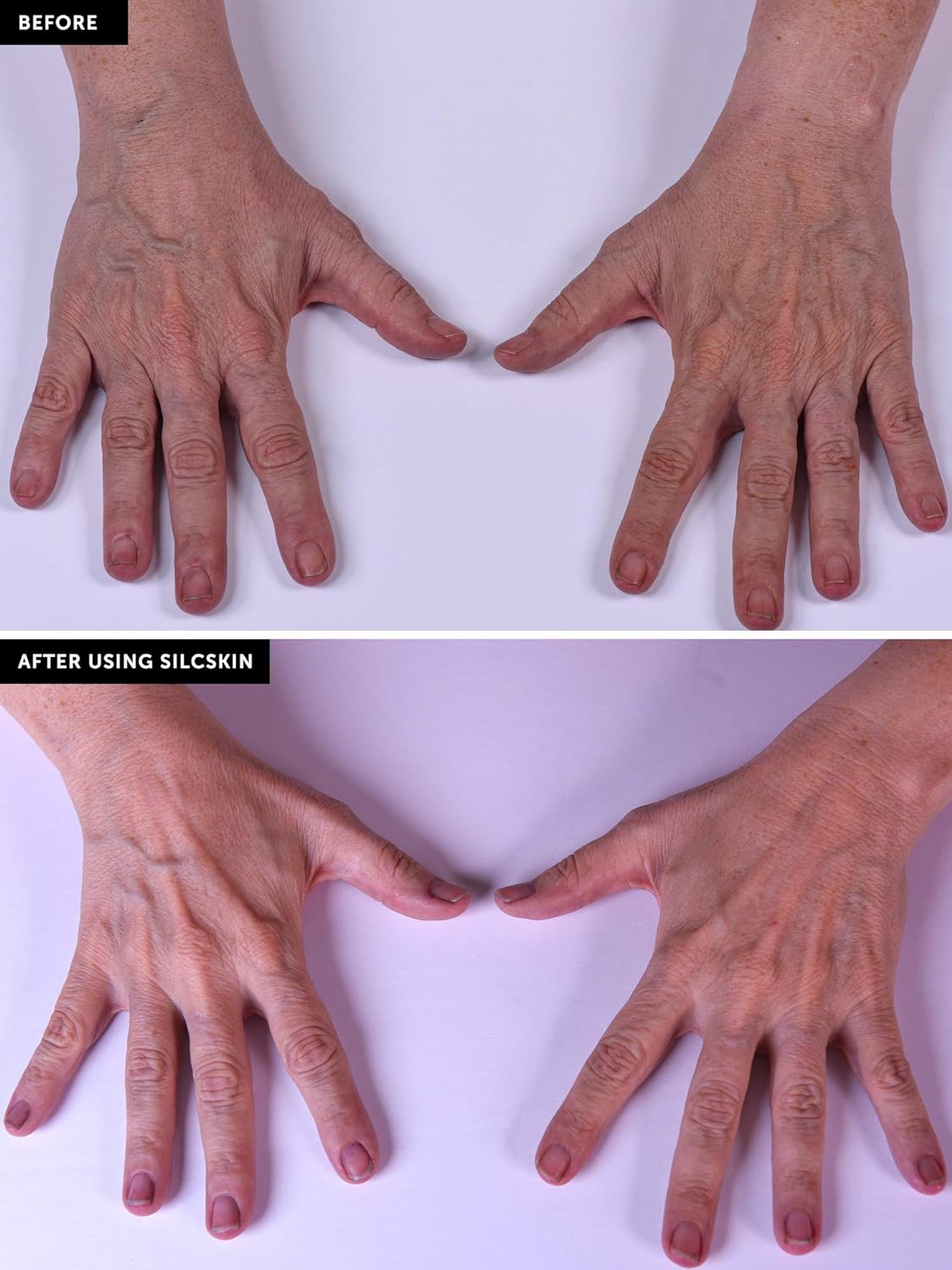 SilcSkin Hand & Body Treatment - Uses Medical Grade Silicone