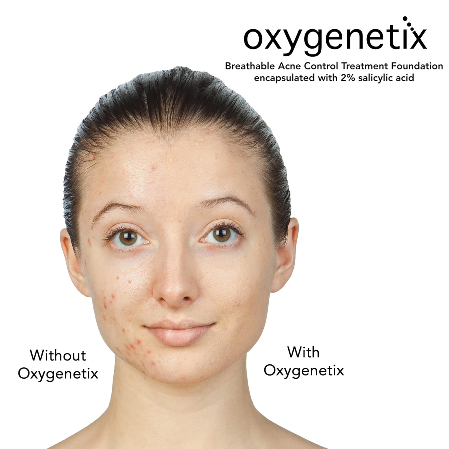 Oxygenetix Acne Control Foundation - 15ml - Mahogany
