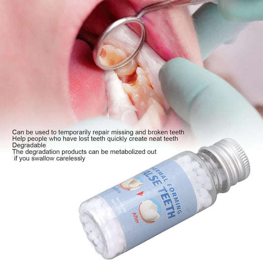 Tooth Filling Thermo Beads, Temporary Tooth Repair Kit, Temporary Veneer Tooth Replacement, for Filling Fix Missing and Broken Tooth, White