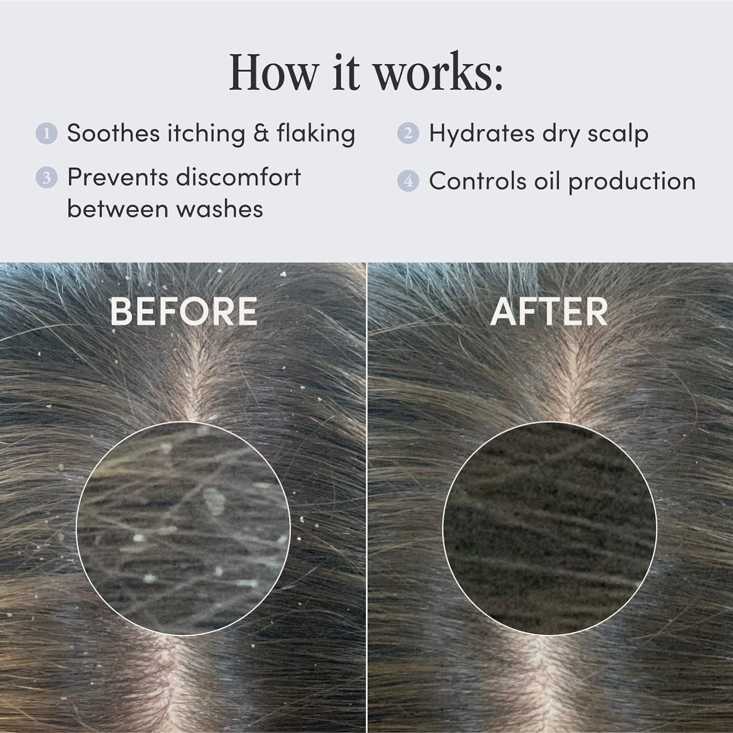 Esupli.com Jupiter Leave On Anti-Dandruff Scalp Serum - Restoring Treat