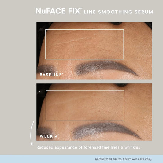 NuFACE FIX Serum – Hydrating, Line Smoothing Serum for Facial Toning Device, 0.5