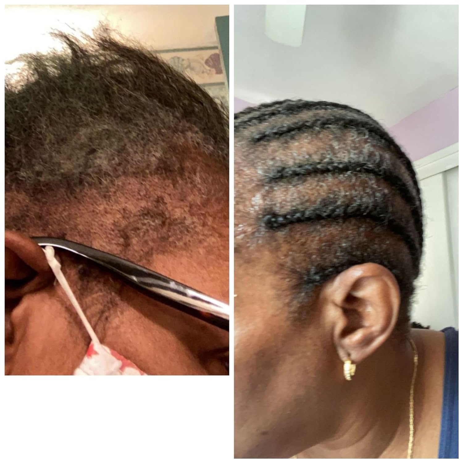  Organic Hair Solution-Rosemary Mint Eucalyptus Scalp & Hair