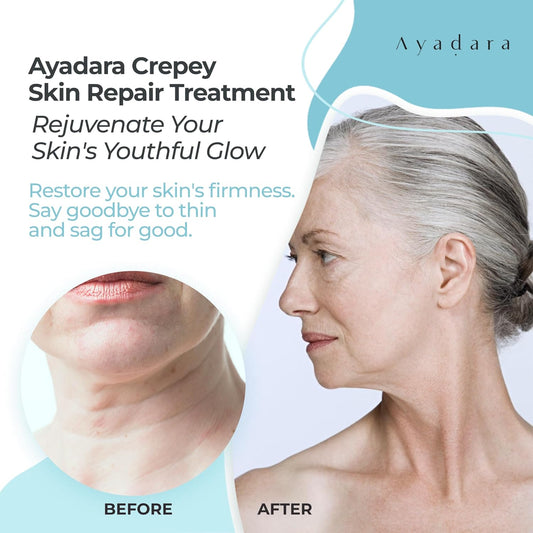 AYADARA Crepey Skin Repair Treatment 8, Firming Lotion for Loose Skin, Crepe Corrector Collagen Cream for Body Skin-Tightening, Wrinkle Cream for Face, Neck, Arms and Legs, 500+ Uses