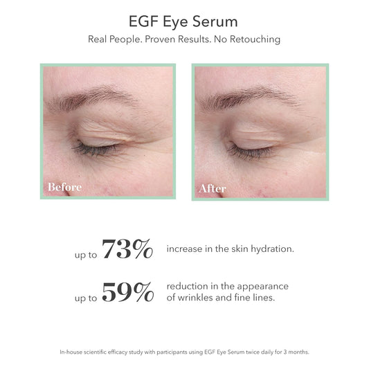 BIOEFFECT EGF Eye Serum with De-Puffer Rollerball, Anti-Aging, Moisturizing Contour Gel To Visibly Reduce Wrinkles, Puffiness, Fine Lines with Barley Growth-Factor Protein