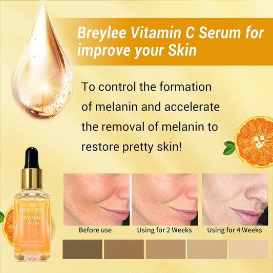 Vitamin C Serum for Face, BREYLEE Vitamin C Facial Serum, Moisturizing Face Serum, Anti Aging Serum for Skin Care, Brightening Skin with Hyaluronic Acid, Vitamin E, Retinol, Nicotinamide 0.6