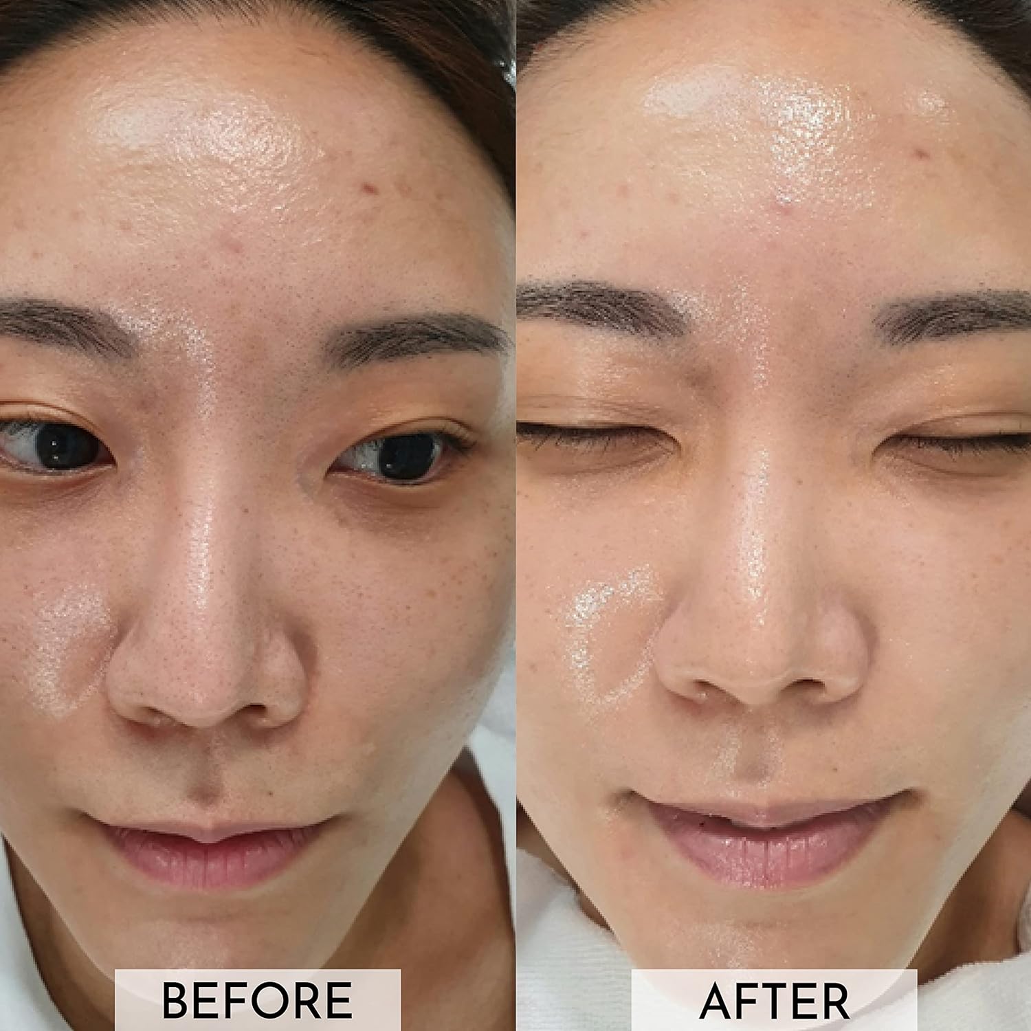 Esupli.com DM.Cell | EGF, FGF Repairing Ampoule | Microneedling EGF Ser