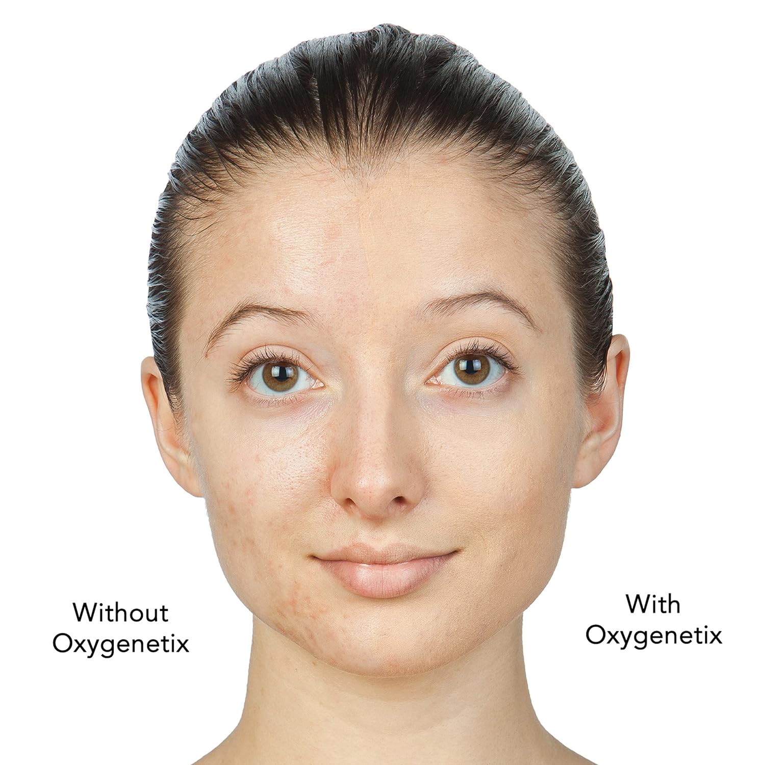 Oxygenetix Oxygenating Foundation - 15ml