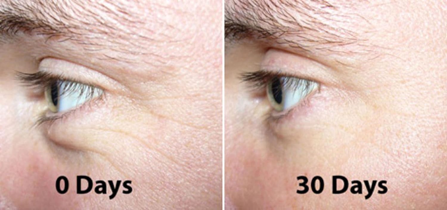 Esupli.com DNA Code®- CoEnzyme Q10 Collagen Rebuild complex Moisturizer