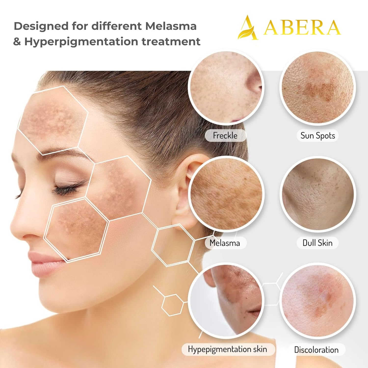 Esupli.com Abera Melasma Treatment for Face, Dark Spot Corrector Serum,