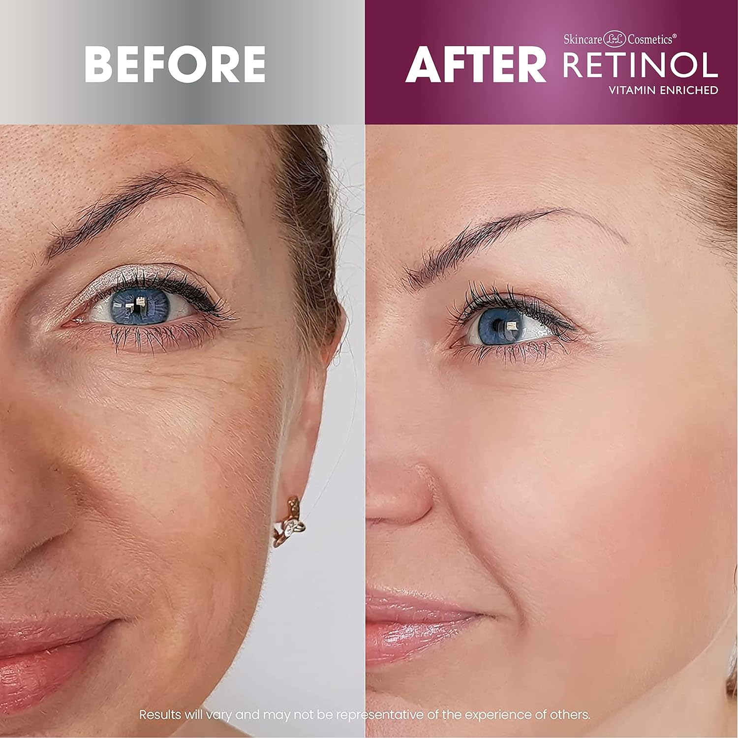 Esupli.com Retinol Anti-Wrinkle Facial Serum – Vitamin A Concentrate Im