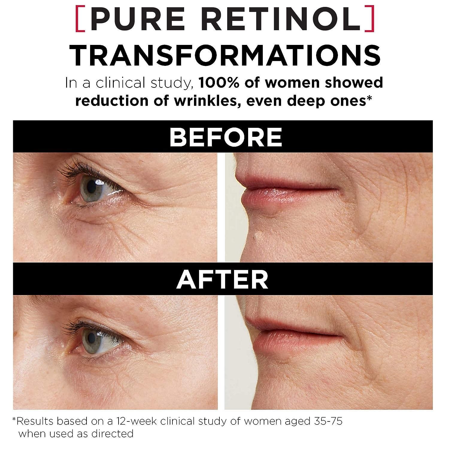 Esupli.com 'L'Oreal Paris Revitalift Triple Power LZR Retinol Night Ser